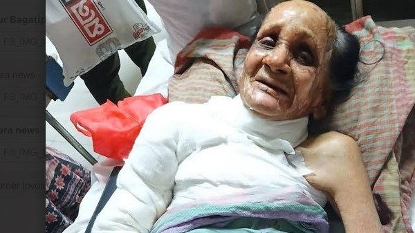 আনোয়ারায় আগুনে বৃদ্ধ মহিলা দগ্ধ