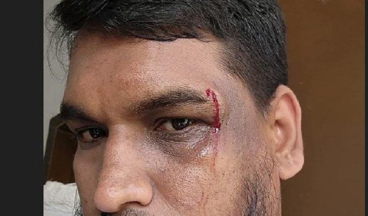 ঈদগাঁওয়ে মাদকের বিরুদ্ধে কথা বলায় শিক্ষকের উপর হামলা