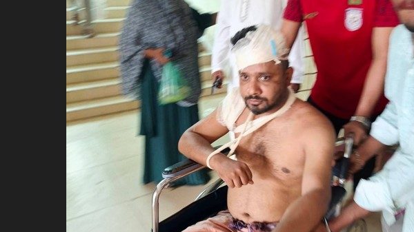 চকরিয়ায় প্রকাশ্যে সন্ত্রাসী হামলা,জখম আইনজীবী