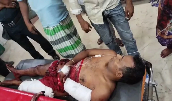 মধ্যরাতে প্রবাসীর ঘরে ঢুকে গুলি, বাবা-ছেলে আহত